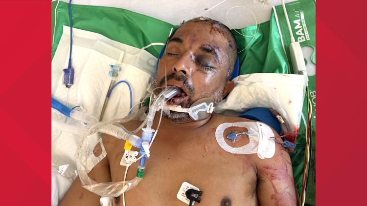 University Hospital asks for help identifying unconscious patient hit by truck Saturday evening — KENS 5 (San Antonio), Columbia Heights Health news